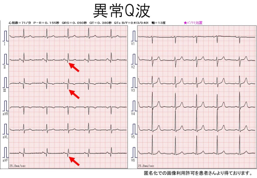 四肢の骨格異常の原因